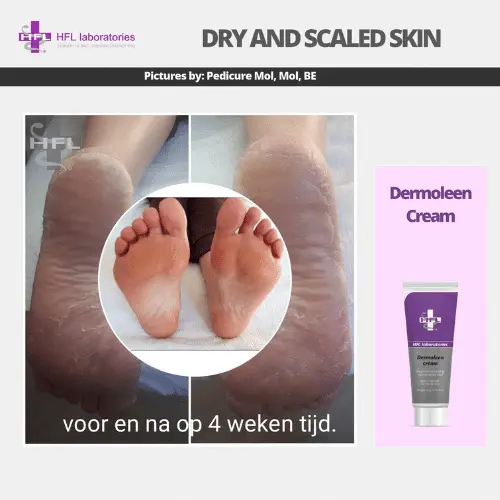 HFL Laboratories Dermoleen kreem 10% uureaga, kuivale nahale - Pilt 10